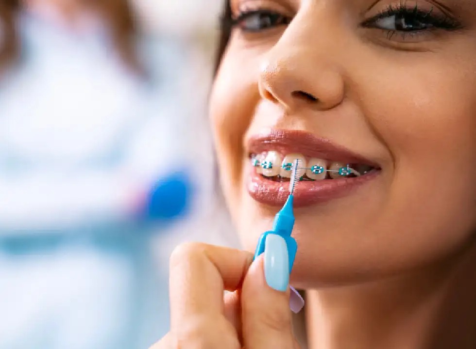The Recovery Timeline After Getting Dental Implants